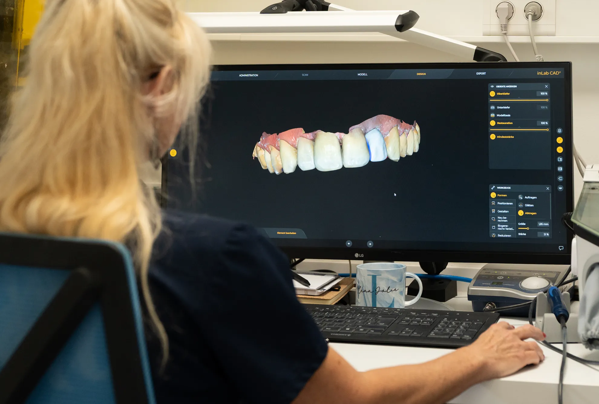 Eine Person an einem Computer, auf dem ein 3D-Modell von Zähnen zu sehen ist